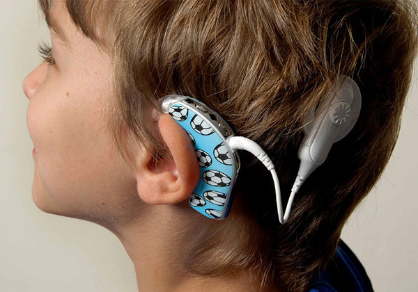روش جدید درمان کم شنوایی